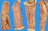 China Elecampane Extract - China Supplier China Elecampane Extract - China Supplier